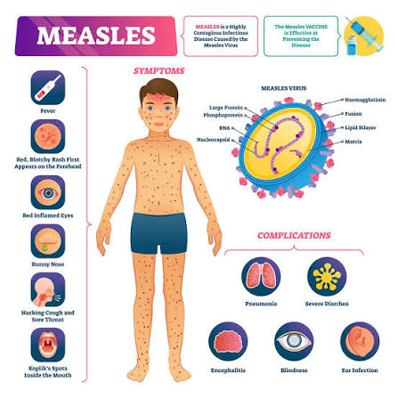 Photograph of a public‑health worker administering a measles/MMR vaccination in a clinic setting; overlay caption noting '2026 measles totals reported higher than 2025 — details pending CDC data.' Avoid sensational imagery; prioritize public‑health context.